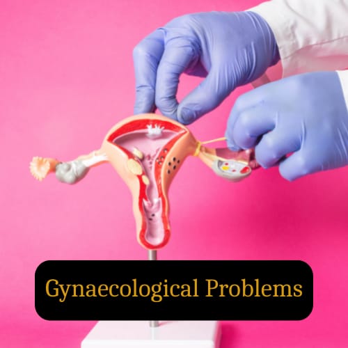 gynecological problems